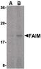 Fas Apoptotic Inhibitory Molecule antibody, PA5-20312, Invitrogen Antibodies, Western Blot image 