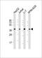 Rho Guanine Nucleotide Exchange Factor 39 antibody, 61-164, ProSci, Western Blot image 