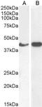 Actin Alpha 2, Smooth Muscle antibody, 45-198, ProSci, Western Blot image 