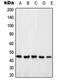 Proteasome 26S Subunit, Non-ATPase 6 antibody, LS-C353205, Lifespan Biosciences, Western Blot image 