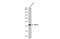 Wnt Family Member 11 antibody, GTX105971, GeneTex, Western Blot image 