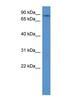 Adducin 3 antibody, NBP1-79783, Novus Biologicals, Western Blot image 