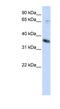 ST6 N-Acetylgalactosaminide Alpha-2,6-Sialyltransferase 1 antibody, NBP1-62649, Novus Biologicals, Western Blot image 