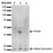 Synuclein Alpha antibody, LS-C773084, Lifespan Biosciences, Western Blot image 
