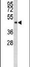 Integrin Linked Kinase antibody, PA5-14686, Invitrogen Antibodies, Western Blot image 