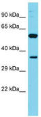 Family With Sequence Similarity 49 Member A antibody, TA331710, Origene, Western Blot image 