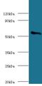 Cytochrome P450 Family 11 Subfamily A Member 1 antibody, LS-C318643, Lifespan Biosciences, Western Blot image 