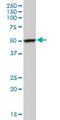 FKBP Prolyl Isomerase 5 antibody, H00002289-B01P, Novus Biologicals, Western Blot image 