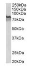 Transglutaminase 2 antibody, orb125199, Biorbyt, Western Blot image 