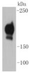 Platelet Derived Growth Factor Receptor Beta antibody, NBP2-67384, Novus Biologicals, Western Blot image 