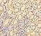 CTD Nuclear Envelope Phosphatase 1 antibody, A54013-100, Epigentek, Immunohistochemistry paraffin image 
