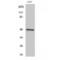 Inhibitor Of Nuclear Factor Kappa B Kinase Regulatory Subunit Gamma antibody, LS-C384091, Lifespan Biosciences, Western Blot image 