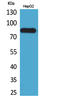 CD248 Molecule antibody, STJ96632, St John