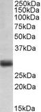 Fibroblast Growth Factor 5 antibody, LS-B10340, Lifespan Biosciences, Western Blot image 