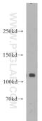 DIS3 Homolog, Exosome Endoribonuclease And 3'-5' Exoribonuclease antibody, 14689-1-AP, Proteintech Group, Western Blot image 