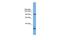 Coiled-Coil Domain Containing 110 antibody, A14233, Boster Biological Technology, Western Blot image 