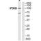 Inositol-Trisphosphate 3-Kinase B antibody, A06023, Boster Biological Technology, Western Blot image 