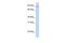 Apoptosis Resistant E3 Ubiquitin Protein Ligase 1 antibody, GTX46607, GeneTex, Western Blot image 