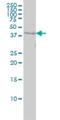 WD Repeat Domain 77 antibody, H00079084-M01, Novus Biologicals, Western Blot image 