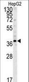 Proteasome 26S Subunit, Non-ATPase 7 antibody, LS-C162245, Lifespan Biosciences, Western Blot image 