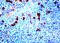 Serpin Family A Member 3 antibody, GTX20921, GeneTex, Immunohistochemistry paraffin image 