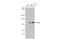 Protein Tyrosine Phosphatase Non-Receptor Type 14 antibody, GTX105769, GeneTex, Western Blot image 