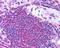 Ubiquitin Associated And SH3 Domain Containing A antibody, TA303187, Origene, Immunohistochemistry paraffin image 