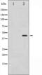 Mitogen-Activated Protein Kinase Kinase 1 antibody, GTX52337, GeneTex, Western Blot image 