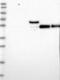 Otoancorin antibody, NBP1-84363, Novus Biologicals, Western Blot image 