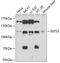 Integrator Complex Subunit 5 antibody, 22-367, ProSci, Western Blot image 