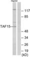 TATA-Box Binding Protein Associated Factor 15 antibody, LS-C119187, Lifespan Biosciences, Western Blot image 