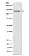 O-GlcNAcase antibody, M32463, Boster Biological Technology, Western Blot image 