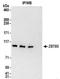 Zinc Finger And BTB Domain Containing 5 antibody, NBP2-32099, Novus Biologicals, Western Blot image 