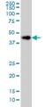 Ceramide Synthase 6 antibody, H00253782-M01, Novus Biologicals, Western Blot image 