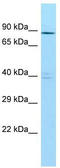 7SK snRNA methylphosphate capping enzyme antibody, TA334325, Origene, Western Blot image 