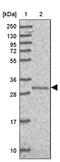 Translocase Of Inner Mitochondrial Membrane Domain Containing 1 antibody, PA5-62760, Invitrogen Antibodies, Western Blot image 