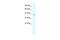 Phosphorylase Kinase Catalytic Subunit Gamma 2 antibody, PA5-40645, Invitrogen Antibodies, Western Blot image 