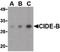 Cell Death Inducing DFFA Like Effector B antibody, PA5-20324, Invitrogen Antibodies, Western Blot image 