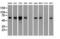 Checkpoint Kinase 2 antibody, LS-C114504, Lifespan Biosciences, Western Blot image 