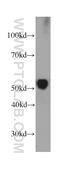 GC Vitamin D Binding Protein antibody, 66175-1-Ig, Proteintech Group, Western Blot image 