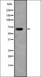 Na(+)/I(-) symporter antibody, orb335077, Biorbyt, Western Blot image 