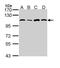 Alanyl-TRNA Synthetase antibody, PA5-29516, Invitrogen Antibodies, Western Blot image 