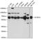 Acyl-CoA Dehydrogenase Very Long Chain antibody, GTX64566, GeneTex, Western Blot image 