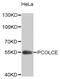 Procollagen C-Endopeptidase Enhancer antibody, MBS128762, MyBioSource, Western Blot image 