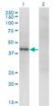 Zinc Finger And SCAN Domain Containing 16 antibody, H00080345-M01, Novus Biologicals, Western Blot image 