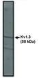 Potassium Voltage-Gated Channel Subfamily A Member 3 antibody, MBS395402, MyBioSource, Western Blot image 