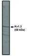 Potassium Voltage-Gated Channel Subfamily A Member 3 antibody, MBS395402, MyBioSource, Western Blot image 