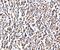 GAR1 Ribonucleoprotein antibody, A07049-1, Boster Biological Technology, Immunohistochemistry paraffin image 