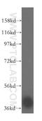 ADP-Ribosylhydrolase Like 2 antibody, 16504-1-AP, Proteintech Group, Western Blot image 