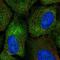 Cytoplasmic Polyadenylation Element Binding Protein 2 antibody, NBP2-56392, Novus Biologicals, Immunofluorescence image 
